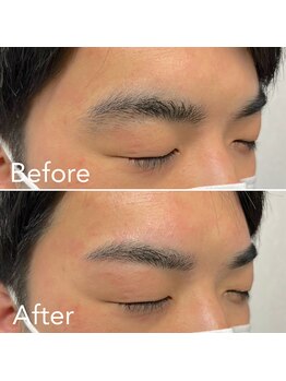 脱毛サロン メンズ 堂々/眉毛ワックス脱毛