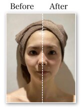 銀座レイア/【VARビフォーアフター】