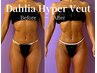 大会応援☆極上BODYライン【専用ハイパーVカット×専門技術者】全身90分