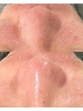 クレーヌ(CREINE)/浮き出た汚れをしっかり吸引