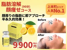 べモーレ 上本町 谷町九丁目(Bemolle)