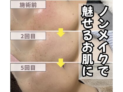 ココ(COCO)の写真