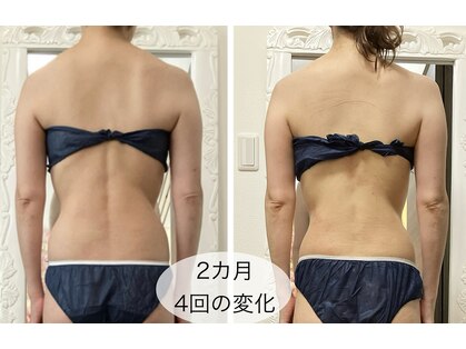 プリンセス ボディの写真