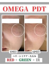 リラ 郡山店(Lilas)/シミケアモード