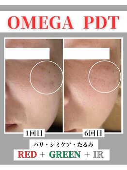 リラ 郡山店(Lilas)/シミケアモード