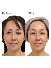 クリニカルスイート エーアール(Clinical sweet.ar)/お顔全体ががキュッと短く小顔に