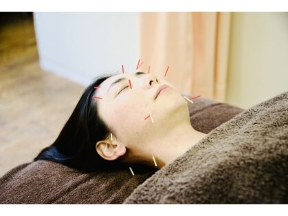 ビューティーパンク 黒田鍼治療院(Beauty Punc)の写真