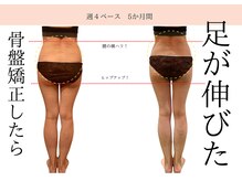 骨盤ちゃん 上越モール店の雰囲気（腰痛や痩身も骨盤を整えて体の変化を毎回変化を実感できる！）