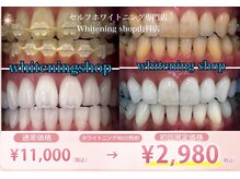ホワイトニングショップ 山科店
