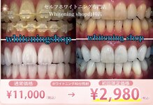 ホワイトニングショップ 山科店