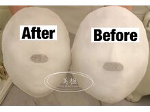 美極 トータルビューティー(美極 TOTAL BEAUTY)/恵比寿/小顔コルギ/エステ/