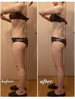 アンフィニ(infini)/短期集中コース5回目(2ヶ月)