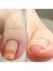 ハチネイルケア(hachi nailcare)の写真/<ジェルネイル卒業/育爪/自爪>保湿しながら行う高技術ウォーターケア&オイルケアで育爪をサポート