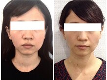 美容整体 ウェリナ 蟹江院/小顔矯正/骨盤矯正/美脚サロン