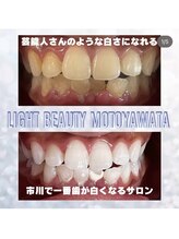 ライトビューティー 本八幡店(LIGHT BEAUTY)/スタッフの歯です♪