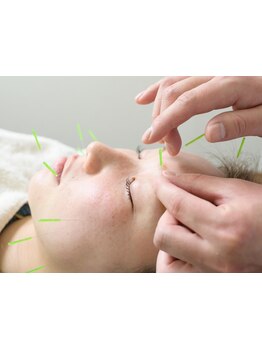 鍼灸施術を受けたい