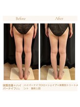 パチュプチ(Patchou petit)/Before→after