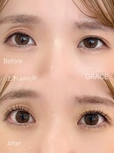 グレイス(GRACE)/左右差解消デザイン☆