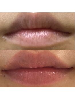 キュライム カブール町田店/映える唇♪