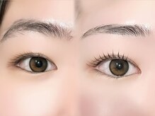 ソナム バイ レンジ(sonam by lange)/Before after