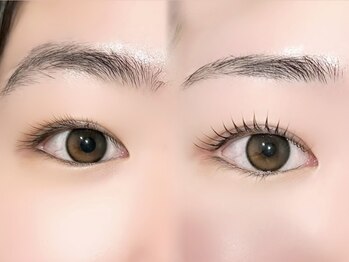 ソナム バイ レンジ(sonam by lange)/Before after