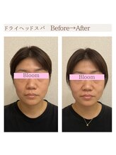 ブルーム(BLOOM)/ドライヘッドスパ　