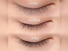 ミライ 大崎(Millieye)