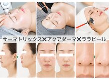 リジュベネーションサロン アリス(Alice)の雰囲気（肌質改善◎お肌悩みも加齢によるお悩みもおまかせください♪）