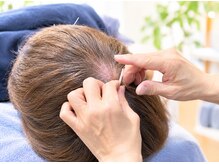 セントラル鍼灸院リラクシー(Re:laxy)の雰囲気（施術中もリラックスできるように工夫しています）