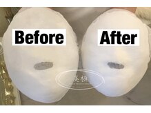 美極 トータルビューティー(美極 TOTAL BEAUTY)/恵比寿/小顔コルギ/エステ/