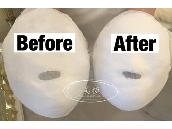 美極 トータルビューティー(美極 TOTAL BEAUTY)/恵比寿/小顔コルギ/エステ/