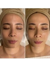 レアリゼ(Realiser)/これからの季節に欠かせない！