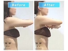 トラレス(Trouless)/