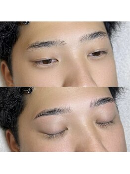 レアファースト/メンズハリウッドブロウリフト