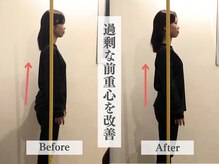 アライメント 自由が丘(Alignment)/前重心を改善（姿勢矯正）