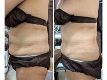 ラグーン(Lagoon)/WINBACK×筋膜リリース