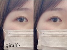 ジラフ(giraffe)/【ラッシュリフト】立ち上げ