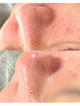 クレーヌ(CREINE)/