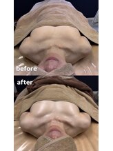 ルナリア ルクス 志木南口駅前店/驚きのビフォーアフター！