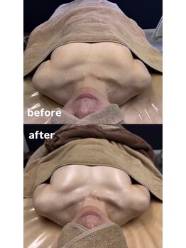 ルナリア ルクス 志木南口駅前店/驚きのビフォーアフター！