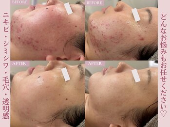 ベベ 表参道(bebe)