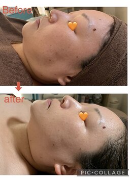 ノレーヴ(NOS REVES)/小顔