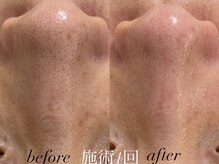 リスポアラボ(LIS PORE.LAB)/