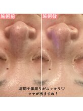 エクラ アン(eclat.un)/40代女性：毛穴スペシャル