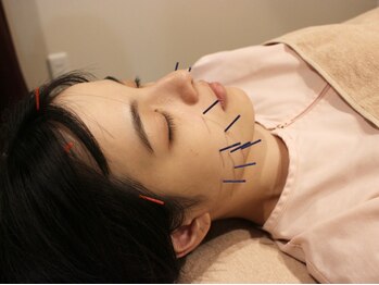 世田谷ビューティークリニークの写真/≪美容鍼はもちろん、身体の痛みや疲労にも◎≫鍼が初めての方・不安な方もお気軽にご来院ください♪