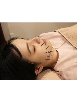 鍼灸施術を受けたい