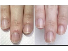 ココネ(cocone)/自爪育成　　