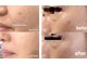 キレイラボ(Ki-Re-i LABO)の写真/【シミ・くすみでお悩みの方へ◎】30代からのエイジングケアで透明感のある美白肌に♪エリアNo.1満足度★