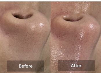 クレーヌ(CREINE)/