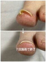 フロー(Froh)/あまり歩かない